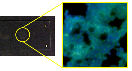 R28 Cytospin