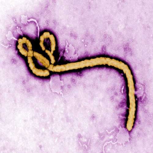 Anti-Zaire Ebola Virus Nucleoprotein [1E6] Antibody