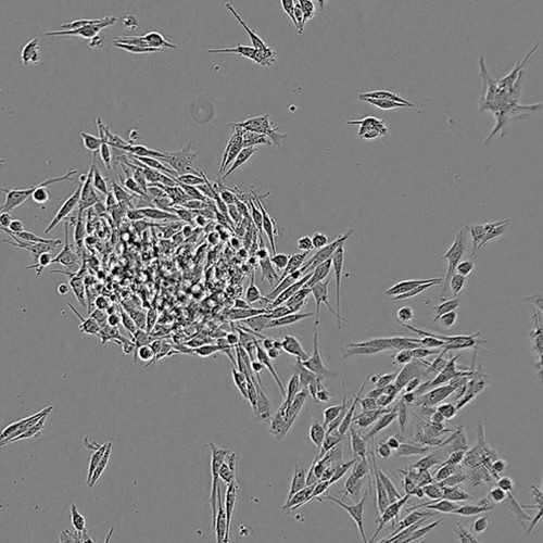 Uveal Melanoma Cell Line (MEL202)