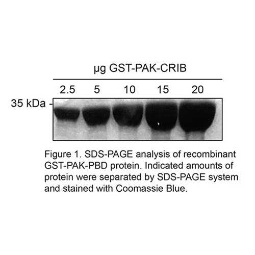 GST-PAK-CRIB Rac/Cdc42 Isolation Kit