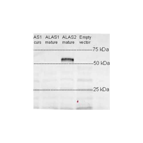 Anti-Delta-Aminolevulinate Synthase 2 (ALAS2) Antibody