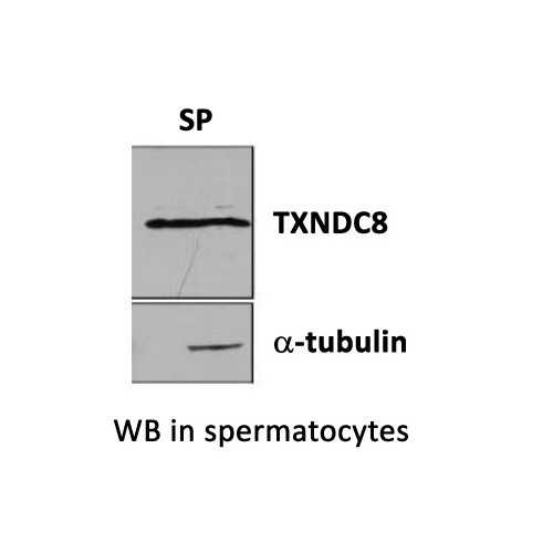 Anti-TXNDC8 (SPTRX-3) Antibody