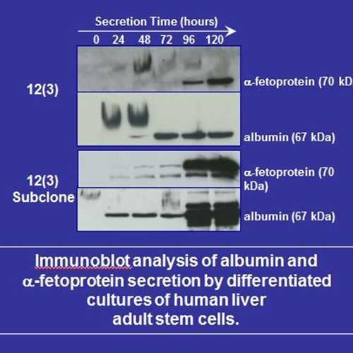 SACK-Xs 12(3) neonatal human liver stem cells