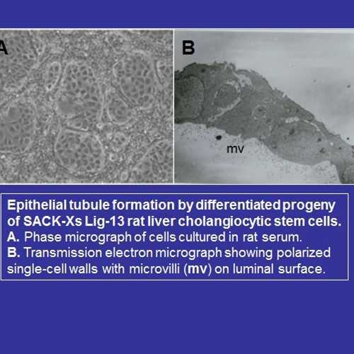 SACK-Xs Lig-13 clonal adult rat cholangiocytic stem cells