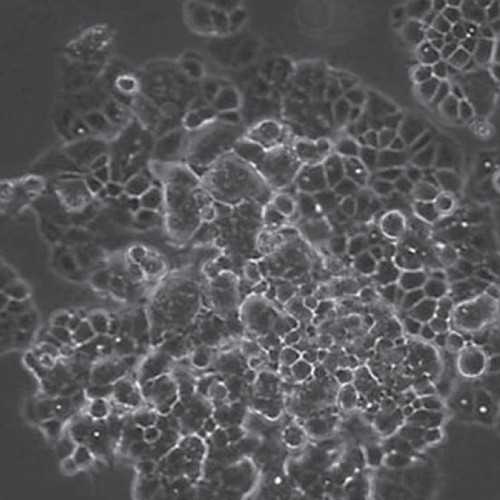 Human Ovarian Yolk Sac Tumor Cell Line NOY1