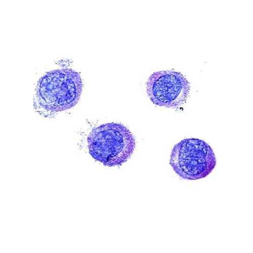 Human Mast Cell Line (LUVA)