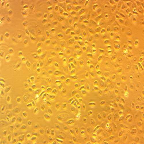 Human Endocervical Epithelial Cells