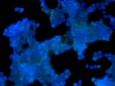 E1A Cytospin