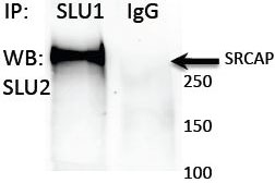 Mutations in SRCAP, Encoding SNF2-Related CREBBP Activator Protein, Cause  Floating-Harbor Syndrome - ScienceDirect